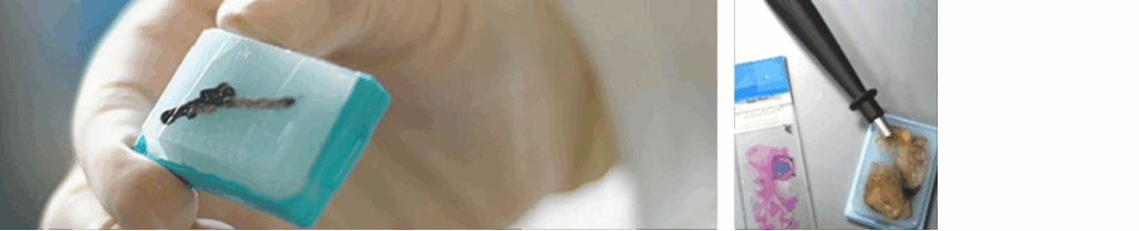 ffpe